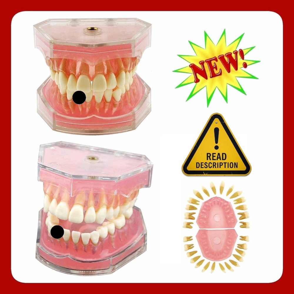Dental Typodont Jaw Model Practice Study Aid Anatomical Teeth Set Missing Tooth
